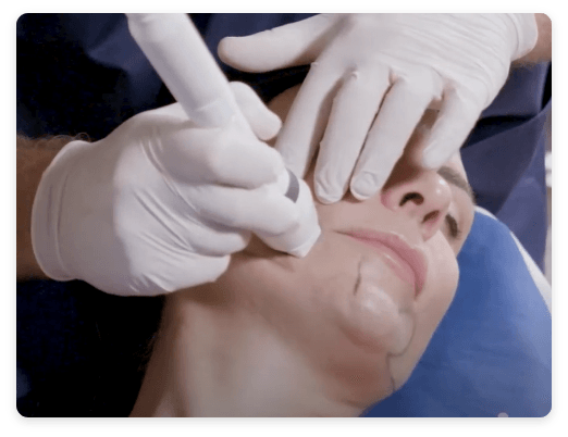 smoothglo treatment
